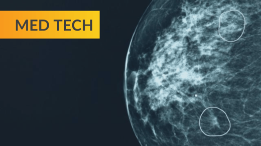 AI tool Mia circles two areas of concern on a mammogram scan